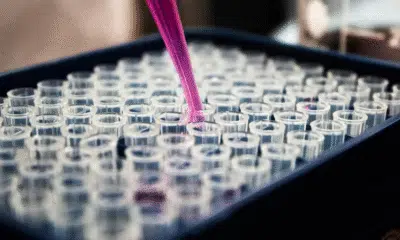 Estudos brasileiros identificam exame de sangue para diagnóstico precoce de Alzheimer