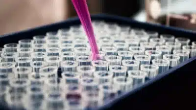 Nobel: Descoberta abre caminho para terapias contra câncer e doenças autoimunes