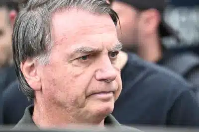Jair Bolsonaro autorizado à cirurgia de hérnia com avaliação médica detalhada