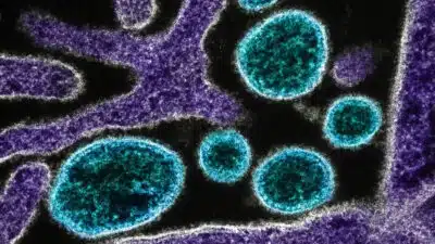 Pesquisadores da China anunciam medicamento VV116 com resultados promissores no NiV