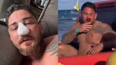 Jhonny Andrade Sofre Agressão Grave em Porto de Galinhas – Fálores e Causa Impacto