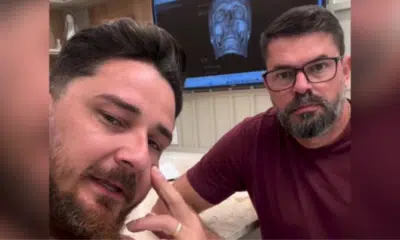 Johnny Andrade Sofre com Fraturas Após Agressão em Pernambuco: Cirurgia e Novo Procedimento