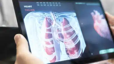 Cirurgia Inédita: Paciente Vive 48 Horas Sem Pulmões e Revoluciona Tratamento!