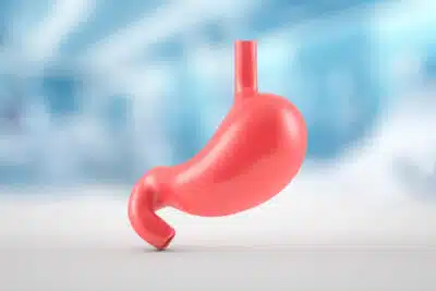 Hipocloridria e Hiperacidez: Desequilíbrios que Afetam a Saúde Digestiva