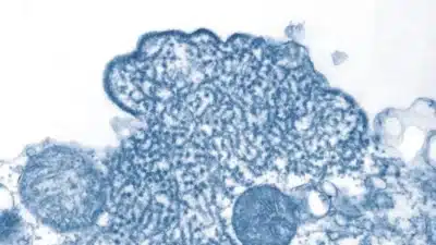 OMS Alerta para Novo Surto de Nipah na Índia e Ações Internacionais