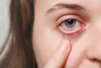 Retinopatia Diabética: Alerta Silencioso – Proteja Sua Visão Antes que Seja Tarde!