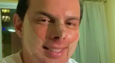 Esdras de Souza Revela Novo Procedimento Estético Após Retomada da Música!