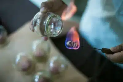 China revoluciona Medicina Tradicional Chinesa com IA: um futuro inovador surge!