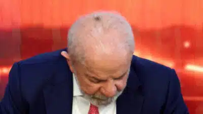 Lula causa surpresa com mancha no couro cabeludo após tratamento em SP!