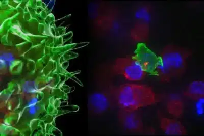 Células T Aprimoradas: Cientistas Chineses Desviam Obstáculos no Combate ao Câncer